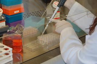 A new Non-Invasive Prenatal Diagnosis for Down Syndrome